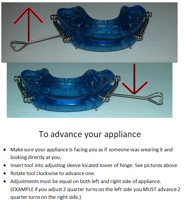 Dental Videos Sleep Dentist North Phoenix Sleep Apnea Dentistry